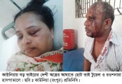 বাবার সম্পত্তির ভাগ নিয়ে
কাউনিয়ায় বড় ভাইয়ের অস্ত্রের আঘাতে ছোট ভাই বোন হাসপাতালে