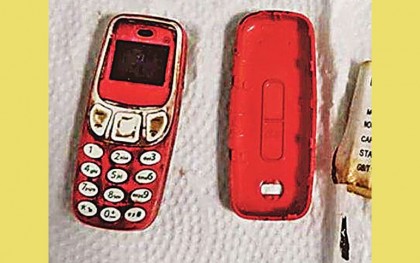 রোগীর পেটে আস্ত মুঠোফোন!