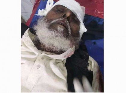 ধুনটের নির্বাচনে বিজয়ী হলেও হাসপাতালে 
মৃত্যু শয্যায় নবনির্বাচিত চেয়ারম্যান!