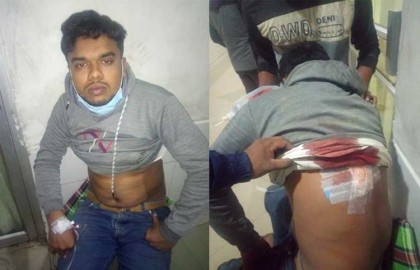 বগুড়ার ধুনটে বখাটেদের ছুরিকাঘাতে
এইচএসসি পরীক্ষার্থী আহত