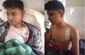 ইউপি নির্বাচনের দ্বন্দ্বের জের...
ধুনটে পরাজিত নৌকা মার্কার চেয়ারম্যান
 প্রার্থীর ছেলেকে ছুরিকাঘাতে আহত