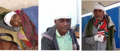 শিবগঞ্জে জমি-জমা সংক্রান্ত জের ধরে অসহায়
পরিবারের ৩ সদস্যকে মারপিট করে আহত