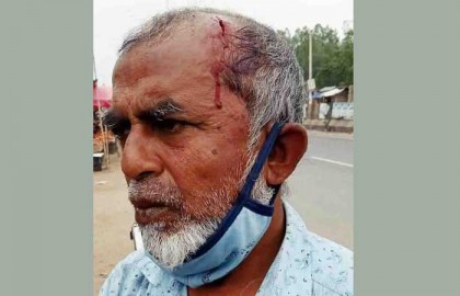 নুনগোলায় সাংবাদিক দুলাল-কে
পূর্ব শত্র“তার জের ধরে মারপিট!