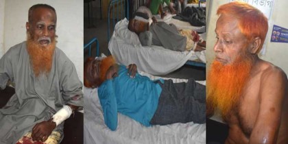 গোবিন্দগঞ্জে পথরোধ করে মারপিট ও ছিনতাইয়ের অভিযোগ