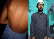 ক্লাসে পড়া না পারায় ধুনটের এক 
মাদ্রাসা ছাত্রকে পিটিয়ে জখম