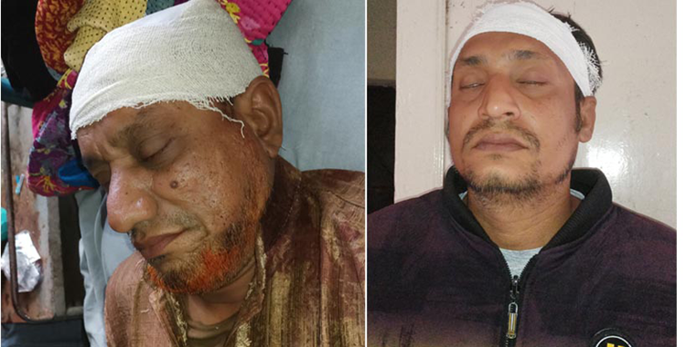 শিবগঞ্জে বিএনপির নেতা কর্তৃক জোরপূর্বক ভাটার জায়গা দখল 
ভাড়ার টাকা না পাওয়ায় মালিকসহ দুই ভাইকে মারপিট  