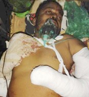 বগুড়ায় ব্যবসায়ীর হাতের কবজি ও
পায়ের গোড়ালি বিচ্ছিন্ন করলো দুবৃর্ত্তরা