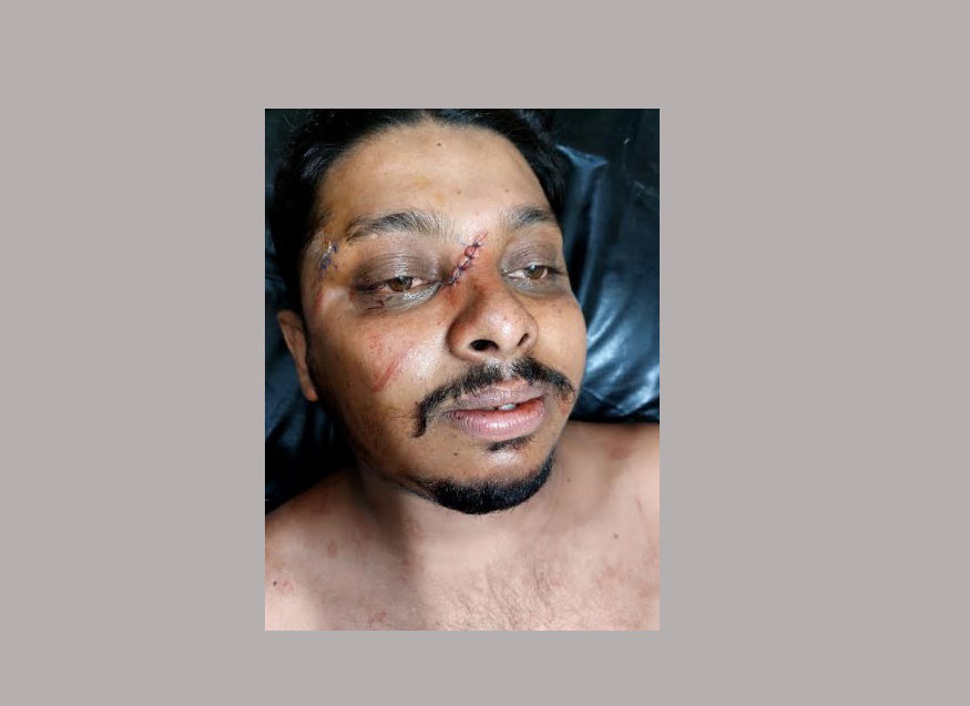 বগুড়ায় জমি সংক্রান্ত বিরোধে পুলিশের বিরুদ্ধে মারধরের অভিযোগ, যুবক হাসপাতালে