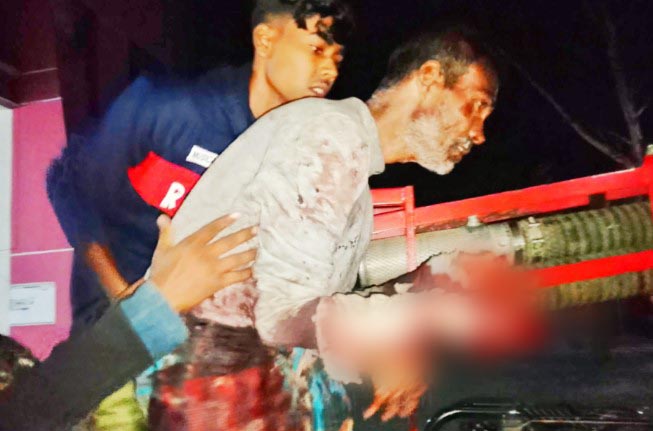 নন্দীগ্রামে সন্ধ্যার পর ছিনতাইকারীদের হামলা: অটোভ্যান চালক হাসপাতালে ভর্তি 