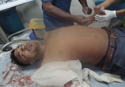 বগুড়ায় মতিন সরকারের শ্যালক আলাল কসাই কুপিয়ে আহত
