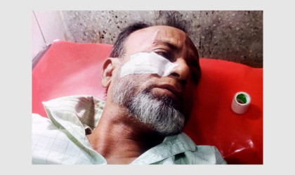 বগুড়ায় চাঁদা না পেয়ে হামলা, টাকা ও স্বর্ণালঙ্কার ছিনতাইয়ের অভিযোগ